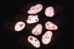 Immunofluorescence staining of HeLa cells (Human cervical epitheloid carcinoma, ATCC CCL-2. (CTBP1 antibody  (AA 345-441))