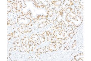Immunohistochemistry (IHC) image for anti-ThPok (AA 250-300) antibody (ABIN7455169) (Recombinant ThPok (AA 250-300) antibody)