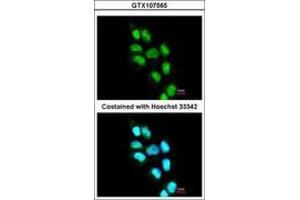 Image no. 2 for anti-Inositol Hexakisphosphate Kinase 2 (IP6K2) (AA 15-200) antibody (ABIN467499) (IP6K2 antibody  (AA 15-200))