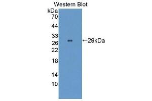 Detection of Recombinant WASP, Human using Polyclonal Antibody to Wiskott Aldrich Syndrome Protein (WASP) (WASP antibody  (AA 39-251))