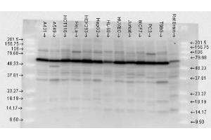Hsp70, human cell lines, polyclonal (HSP70 antibody)