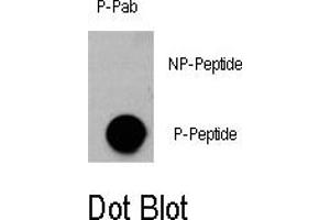 Image no. 1 for anti-V-Akt Murine Thymoma Viral Oncogene Homolog 3 (Protein Kinase B, Gamma) (AKT3) (pSer472) antibody (ABIN358400) (AKT3 antibody  (pSer472))