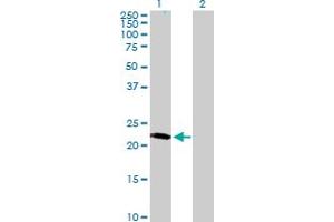 Western Blot analysis of LRRC29 expression in transfected 293T cell line by LRRC29 MaxPab polyclonal antibody. (LRRC29 antibody  (AA 1-223))