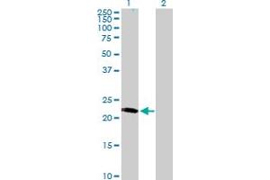 LRRC29 antibody  (AA 1-223)