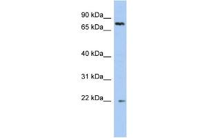 WB Suggested Anti-NHLRC2 Antibody Titration: 0. (NHLRC2 antibody  (N-Term))