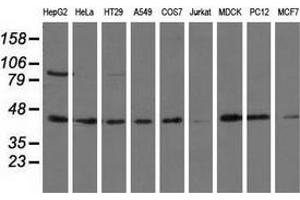 Western blot analysis of extracts (35 µg) from 9 different cell lines by using anti-ALDH1L1 monoclonal antibody. (ALDH1L1 antibody)