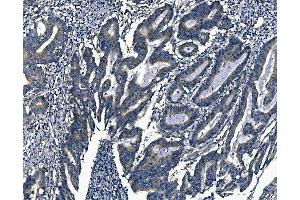 IHC analysis of Agrin/AGRN using anti-Agrin/AGRN antibody (ABIN7600387). (AGRN antibody  (AA 1864-2068))