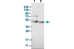 CYP26B1 Antikörper  (AA 201-310)