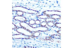 Immunohistochemistry of paraffin-embedded Mouse kidney using TBCCD1 Rabbit pAb (ABIN7270751) at dilution of 1:100 (40x lens). (TBCCD1 antibody)