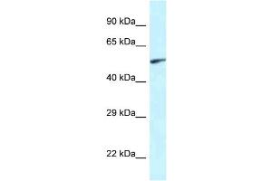 WB Suggested Anti-Eya2 Antibody Titration: 1. (EYA2 antibody  (Middle Region))