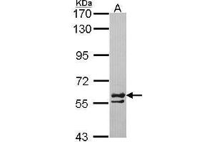 WB Image Sample (30 ug of whole cell lysate) A: H1299 7. (CCT6A antibody)