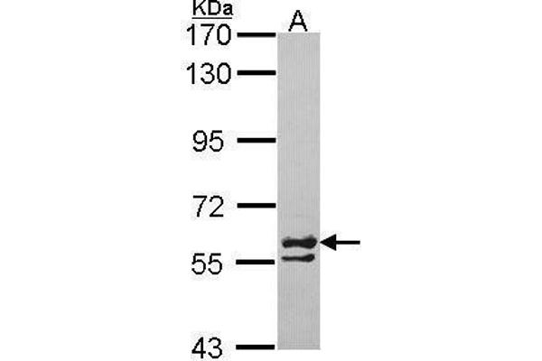CCT6A antibody