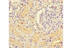 Immunohistochemistry of paraffin-embedded human kidney tissue using ABIN7154769 at dilution of 1:100 (GUCY1A1 antibody  (AA 20-152))