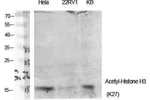 Western Blot (WB) analysis of specific cells using Acetyl-Histone H3 (K27) Polyclonal Antibody. (Histone 3 antibody  (H3K27ac))