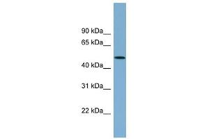 ACTR3B antibody used at 1 ug/ml to detect target protein. (ACTR3B antibody)