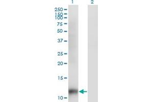 Western Blot analysis of SNAPC5 expression in transfected 293T cell line by SNAPC5 monoclonal antibody (M07), clone 6G10. (SNAPC5 antibody  (AA 1-68))