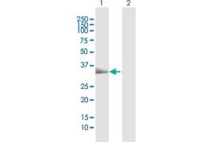 Western Blot analysis of TIRAP expression in transfected 293T cell line by TIRAP MaxPab polyclonal antibody. (TIRAP antibody  (AA 1-256))