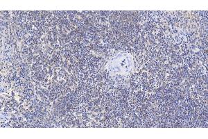 Detection of b2M in Human Spleen Tissue using Monoclonal Antibody to Beta-2-Microglobulin (b2M) (beta-2 Microglobulin antibody  (AA 22-119))