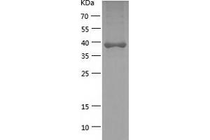 Western Blotting (WB) image for Glycerol-3-Phosphate Dehydrogenase 1 (Soluble) (GPD1) (AA 1-349) protein (His tag) (ABIN7123157) (GPD1 Protein (AA 1-349) (His tag))