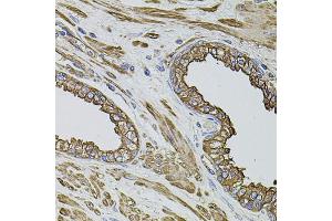 Immunohistochemistry of paraffin-embedded human prostate using FLNB antibody. (FLNB antibody)