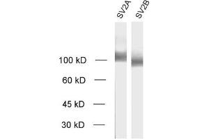 SV2B antibody  (AA 2-17)