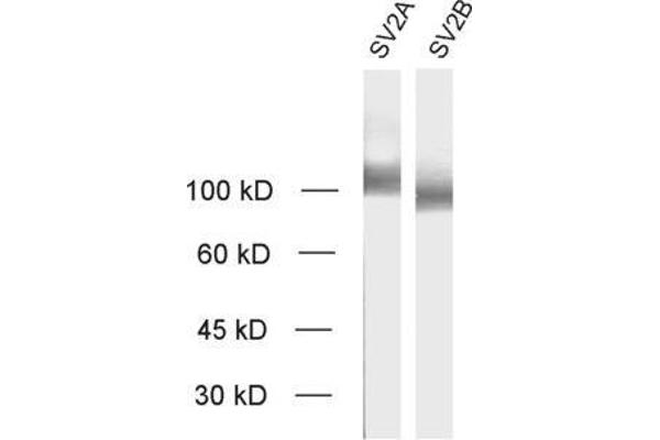 SV2B Antikörper  (AA 2-17)