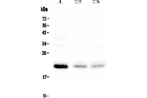 Western blot analysis of BNIP3 using anti-BNIP3 antibody . (BNIP3 antibody)