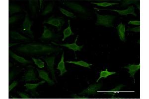 Immunofluorescence of monoclonal antibody to C14orf129 on HeLa cell. (GSKIP antibody  (AA 1-139))