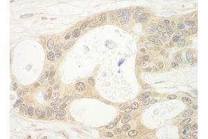 Immunohistochemistry (IHC) image for anti-Folliculin (FLCN) (AA 1-50) antibody (ABIN7448434) (FLCN antibody  (AA 1-50))
