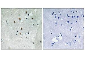Immunohistochemistry analysis of paraffin-embedded human brain tissue using SRF (Phospho-Ser77) antibody. (SRF antibody  (pSer77))