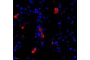 Immunofluorescence of paraffin embedded mouse lymph node using BIRC3 (ABIN7073179) at dilution of 1: 1000 (400x lens)
