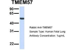 Host:  Rabbit  Target Name:  TMEM57  Sample Type:  Human Fetal Lung  Antibody Dilution:  1. (TMEM57 antibody  (N-Term))