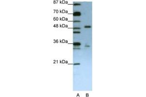 Western Blotting (WB) image for anti-UPF3 Regulator of Nonsense Transcripts Homolog B (UPF3B) antibody (ABIN2462297) (UPF3B antibody)