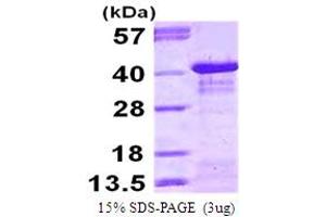 SDS-PAGE (SDS) image for Nuclear Factor of kappa Light Polypeptide Gene Enhancer in B-Cells Inhibitor, alpha (NFKBIA) (AA 1-317) protein (His tag) (ABIN667968) (NFKBIA Protein (AA 1-317) (His tag))