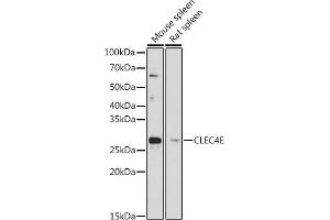 Western blot analysis of extracts of various cell lines, using CLEC4E antibody (ABIN7265982) at 1:1000 dilution. (CLEC4E antibody)