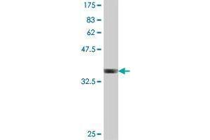 Western Blot detection against Immunogen (35. (CYFIP2 antibody  (AA 733-820))