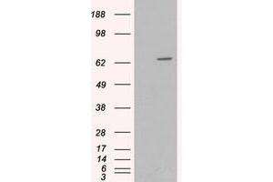 Image no. 2 for anti-Myotubularin 1 (MTM1) (C-Term) antibody (ABIN374119) (MTM1 antibody  (C-Term))