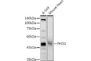 Western blot analysis of extracts of various cell lines, using PHD2 antibody (ABIN7266909) at 1:1000 dilution. (EGLN1 antibody  (AA 1-426))