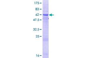 Image no. 1 for Ficolin (Collagen/fibrinogen Domain Containing Lectin) 2 (Hucolin) (FCN2) (AA 1-313) protein (GST tag) (ABIN1353912) (Ficolin 2 Protein (AA 1-313) (GST tag))