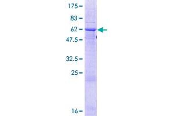 Ficolin 2 Protein (AA 1-313) (GST tag)