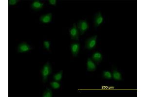 Image no. 2 for anti-AT Rich Interactive Domain 1B (SWI1-Like) (ARID1B) (AA 1364-1461) antibody (ABIN599288) (ARID1B antibody  (AA 1364-1461))