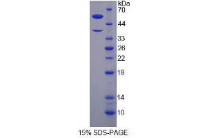 SDS-PAGE analysis of Human H2AFY Protein.
