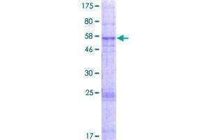 GHITM Protein (AA 1-345) (GST tag)