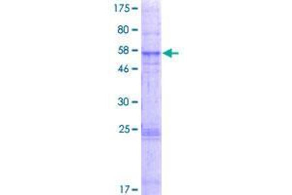 GHITM Protein (AA 1-345) (GST tag)