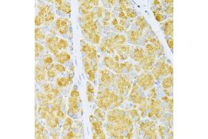 Immunohistochemistry of paraffin-embedded rat pancreas using FLT3 antibody (ABIN6134576, ABIN6140691, ABIN6140694 and ABIN6216061) at dilution of 1:100 (40x lens).