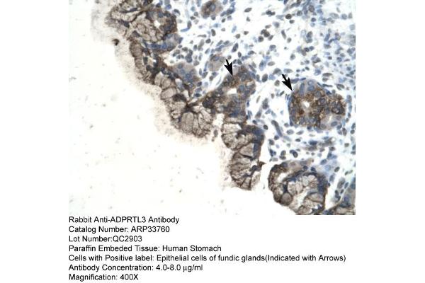 PARP3 antibody  (C-Term)