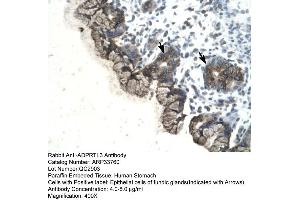 Human Stomach (PARP3 antibody  (C-Term))