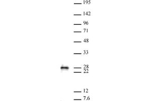 MGMT antibody (pAb) tested by Western blot. (MGMT antibody  (C-Term))