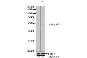 Western blot analysis of extracts of 293T cells, using Phospho-c-Myc-T58 antibody (ABIN3019538, ABIN3019539, ABIN3019540 and ABIN6225454) at 1:500 dilution. (c-MYC antibody  (pThr58))