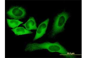 Immunofluorescence of monoclonal antibody to FASN on HeLa cell.